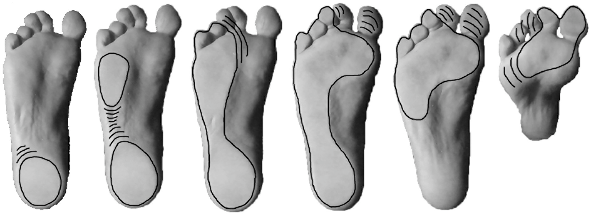 Why do my feet hurt? « Put Your Best Feet Forward